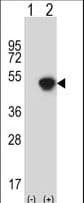 GCAT Antibody (aa101-128)