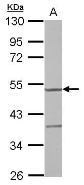 YARS2 Antibody