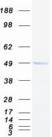 Human IL3RA / CD123 Protein (Recombinant Myc-DDK (Flag))