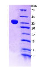 Rat ANGPTL4 Protein (Recombinant His-S)
