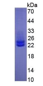Human IL6 / Interleukin 6 Protein (Recombinant His, N-Terminal)