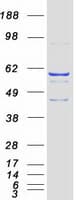 Human CYP2J2 Protein (Recombinant Myc-DDK (Flag))