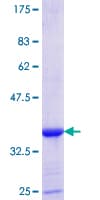 Human IRS Protein (Recombinant GST, N-terminus)