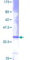 Human IL8 / Interleukin 8 Protein (Recombinant GST)