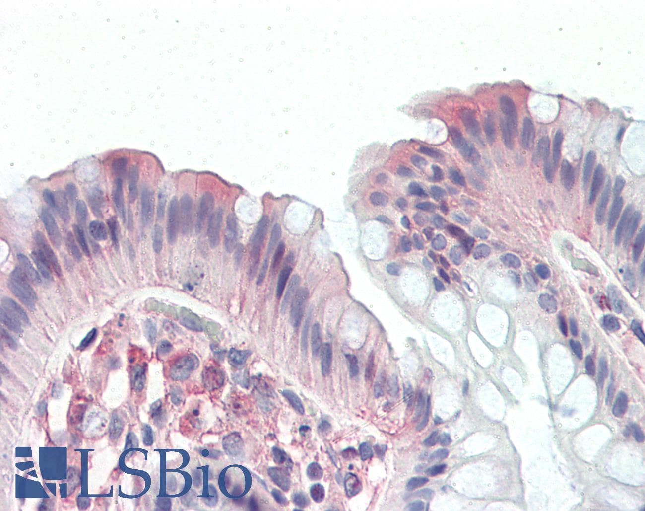 IHC-plus™ ADGRE5 / CD97 Antibody (N-Terminus)