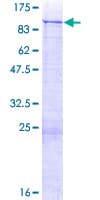 Human ZNF254 Protein (Recombinant GST)