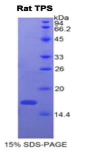 Rat Tryptase Protein (Recombinant His)