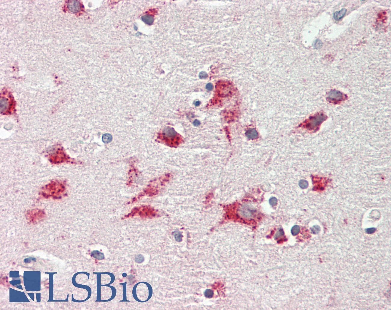 PathPlus™ Polyclonal Rabbit anti-Mouse CTSD / Cathepsin D Antibody (C-Terminus, IHC, WB)