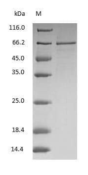 ALB / Serum Albumin Protein (Native)