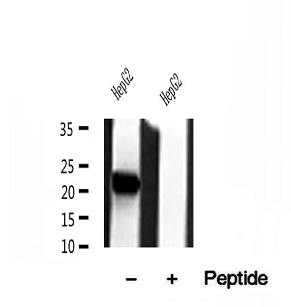 Polyclonal Rabbit anti-Human TIM23 Antibody (IHC, WB)