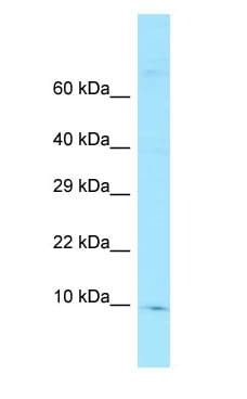 FKBP1A / FKBP12 Antibody (aa20-69)