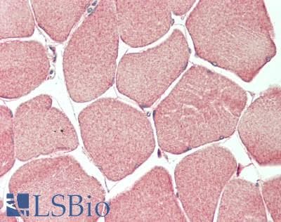 IHC-plus™ CAPN3 / Calpain 3 Antibody