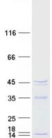 Human MRM1 Protein (Recombinant Myc-DDK (Flag))