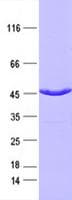 Human IDH2 Protein (Recombinant DDK,C-terminus)