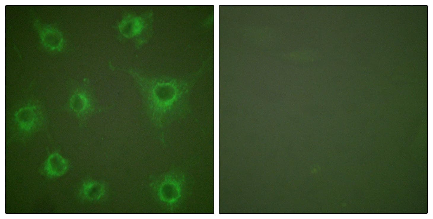 Collagen II Antibody