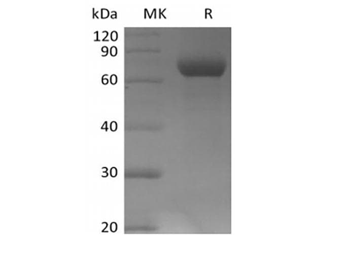 Human LILRB2 / ILT4 Protein (Recombinant AVI-6His, C-terminus)