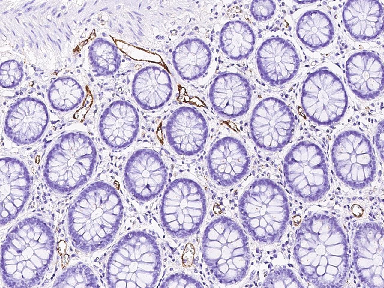 VWF / Von Willebrand Factor Antibody