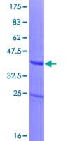 Human ZNF343 Protein (Recombinant GST)