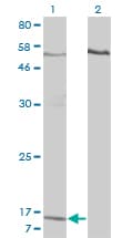 CXCL7 / PPBP Antibody (clone 3B9)