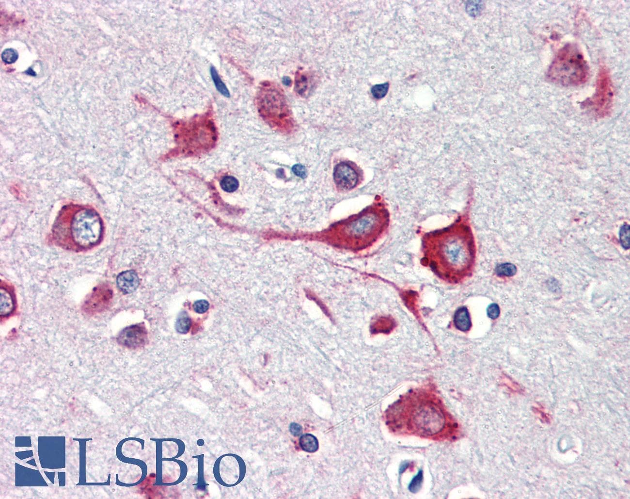 PathPlus™ Monoclonal Mouse anti-Human CALR / Calreticulin Antibody (clone 5F12-B10, IHC, WB)