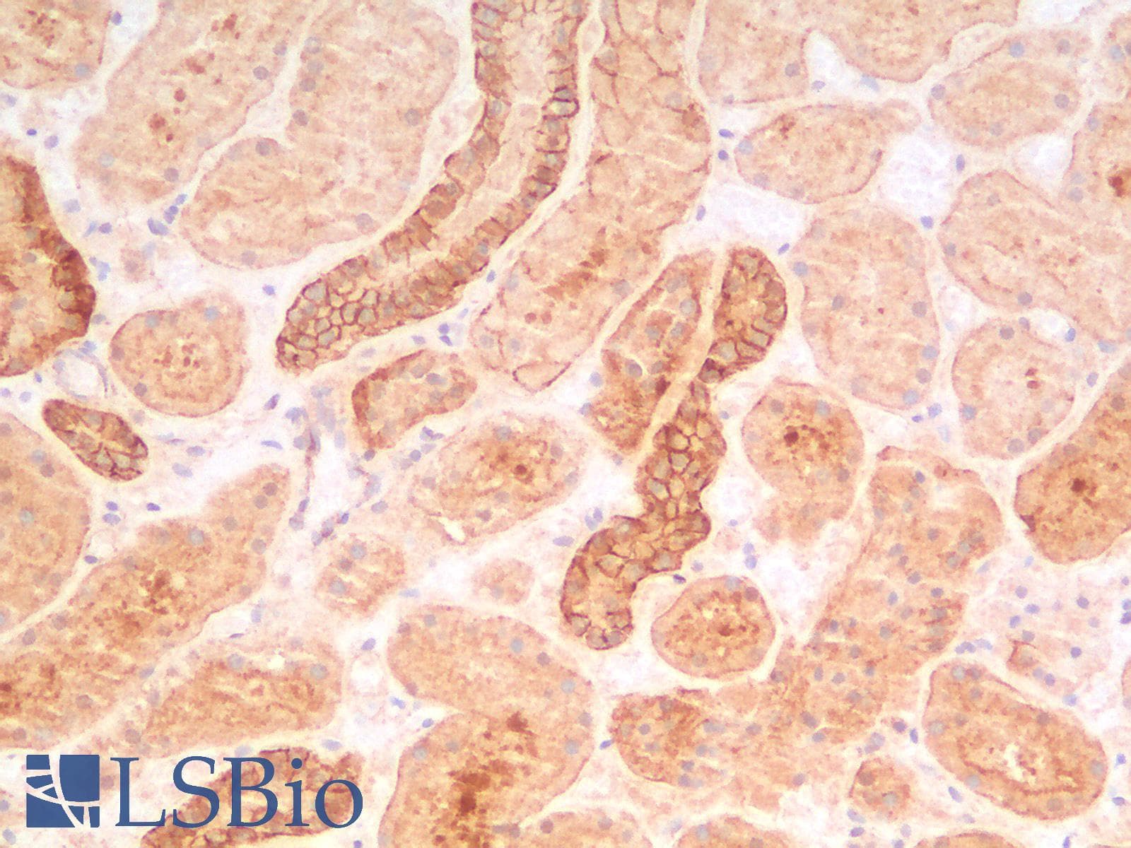 PathPlus™ CTNNB1 / Beta Catenin Antibody (clone CTNNB1/2030R)