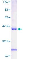 Human ACAT1 Protein (Recombinant GST)
