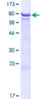 Human Carboxylesterase 3 / CES3 Protein (Recombinant GST)