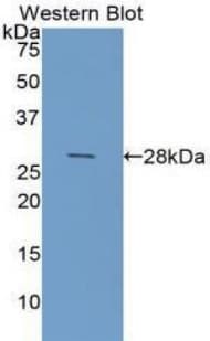 LGALS3 / Galectin 3 Antibody (aa1-250)