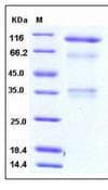 Human HGFAC / HGFA Protein (Recombinant His,C-terminus)