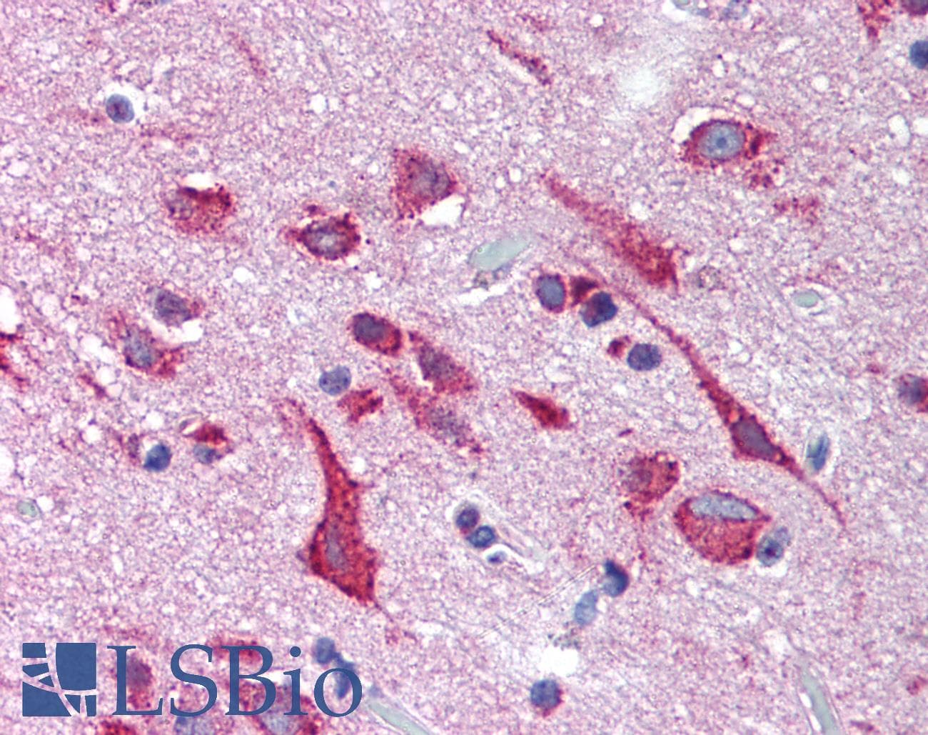 IHC-plus™ KCNH2 / HERG Antibody (Internal)