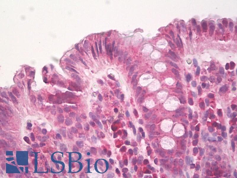 HPSE / Heparanase Antibody (aa68-117)