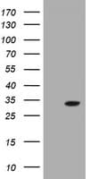 GSTO2 Antibody (clone OTI5E7)