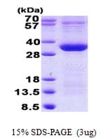 Human PIM1 / Pim-1 Protein (Recombinant His)