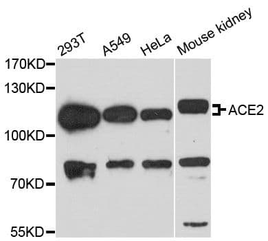 Polyclonal Rabbit anti-Human ACE2 / ACE-2 Antibody (WB)