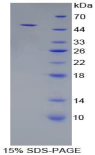 Human CD83 Protein (Recombinant His-GST)