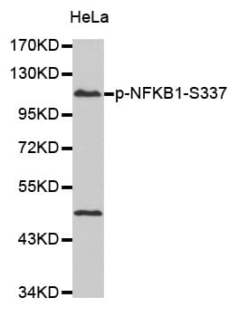 NFKB1 / NF-Kappa-B Antibody (phospho-Ser337)