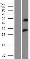 RSRC2 Protein (Over-Expression Lysate Myc-DDK (Flag))