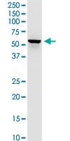 DLST / E2 Antibody (clone 4D7)