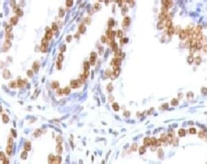 AR / Androgen Receptor Antibody (clone ANDRC-1)