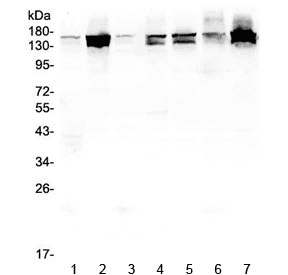 INPPL1 / SHIP2 Antibody