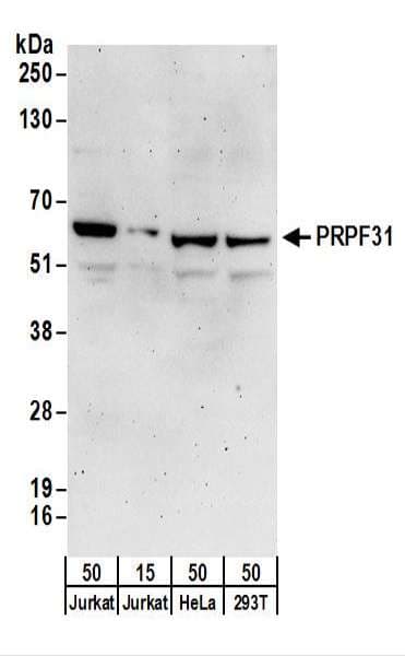 PRPF31 Antibody (aa449-499)