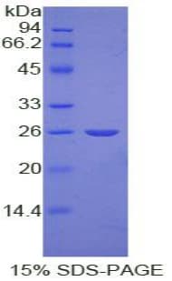 Human NCL / Nucleolin Protein (Recombinant His-S)