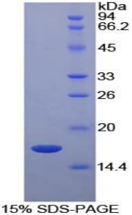 Bovine RBP5 Protein (Recombinant His)