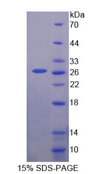 Mouse PRL / Prolactin Protein (Recombinant His, N-Terminal)