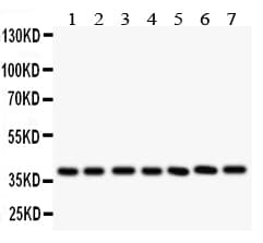 LIF Antibody (aa175-194)