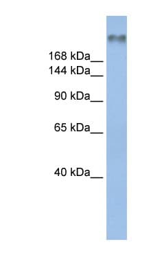 SCN8A / Nav1.6 Antibody (aa1116-1165)