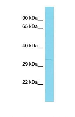 CUEDC2 Antibody (aa71-120)