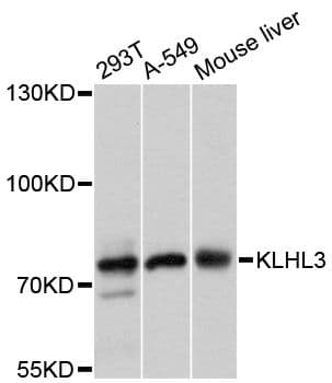 KLHL3 Antibody