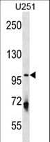 Polyclonal Rabbit anti-Human ULK1 Antibody (aa538-564, WB)