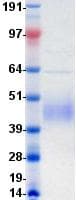 Human CD80 Protein (Recombinant DDK (Flag)-His, C-terminus)
